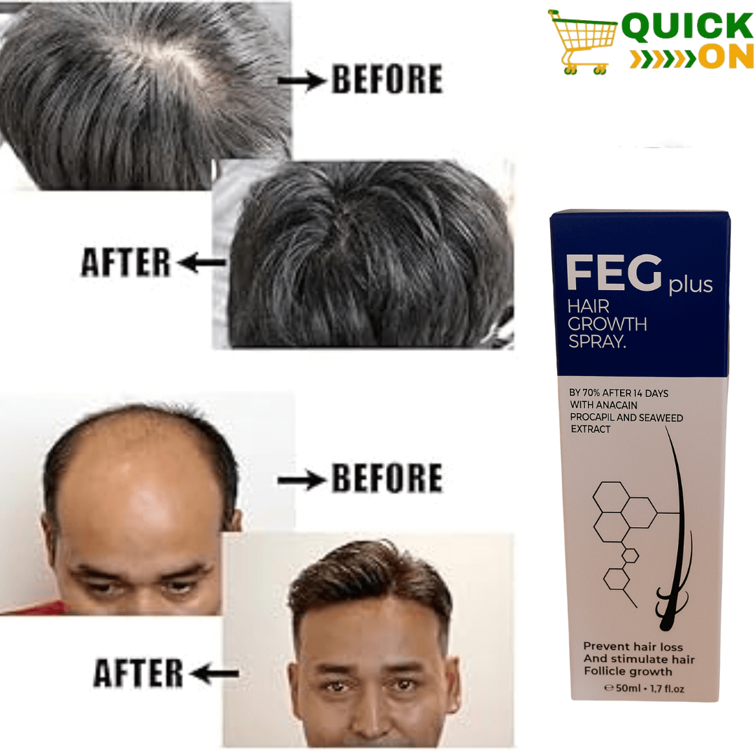 FEG Plus Hair Growth Spray Price in Multan